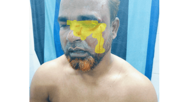 বগুড়ায় শহীদ মিনারে ফুল দিয়ে ফেরার পথে নাগরিক ঐক্যের আহবায়ক ছুরিকাহত